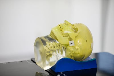 用于癌症病人放射治疗的医用直线加速器(LINAC)上模仿人体头部的人体组织
