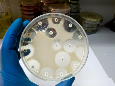 微生物实验室对肺炎克雷伯菌(K. pneumoniae)细菌的皮氏培养皿药敏试验。