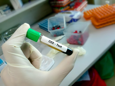 科学家手持血液样本进行二氧化碳测试