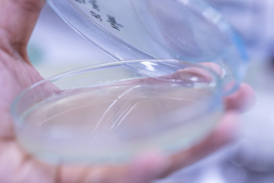 教育用培养皿中酵母菌落特性研究。