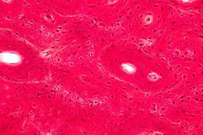 教育观念:解剖学和生理学的紧实骨，或实验室显微镜下的皮质骨。