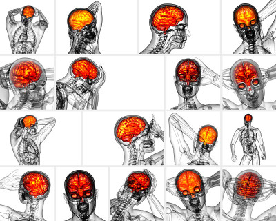 3d渲染的医学插图的大脑