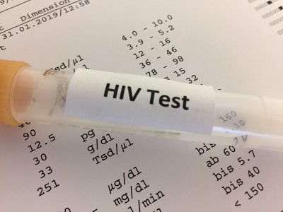 HIV实验室检测用试管