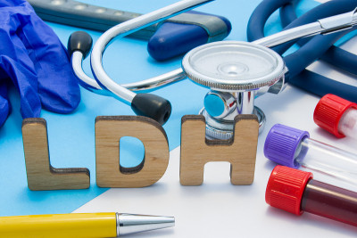 LDH医学实验室缩写意思是乳酸脱氢酶制造LDH单词的字母，位于带血的试管附近，听诊器和其他诊断工具和