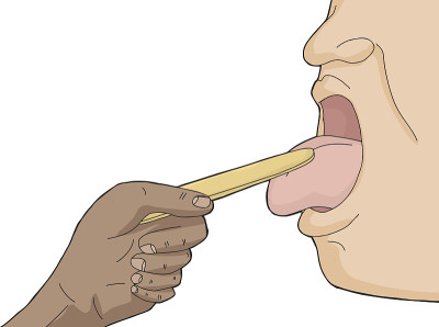 人要检查