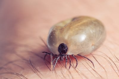 人皮肤上长满血的蜱虫
