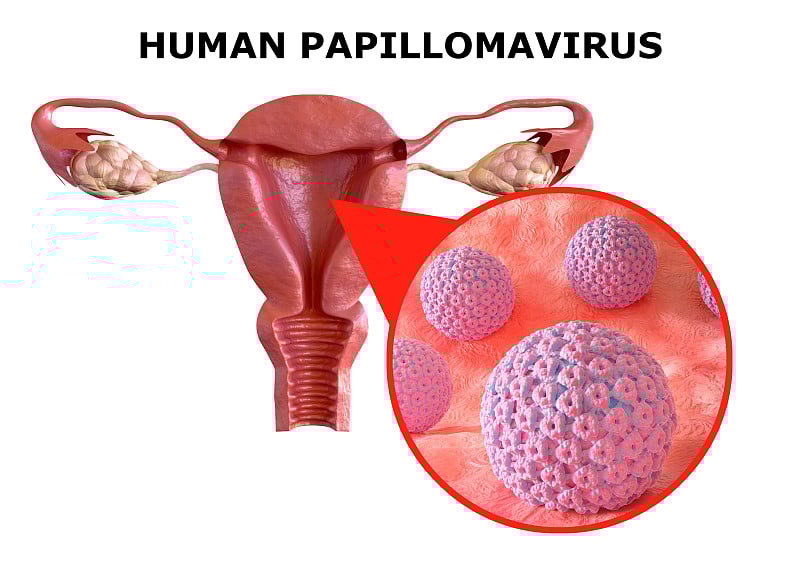 人类乳头瘤病毒(HPV)是一种性传播感染。它会在皮肤、口腔、肛门和生殖器部位造成疣。
