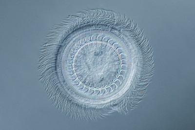 Ciliat Trichodina虱
