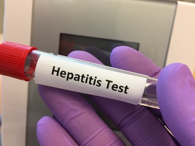 用于病毒性肝炎血液检测的试管