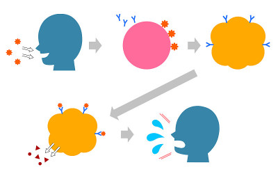 Illustrated pollinosis Explanation cause