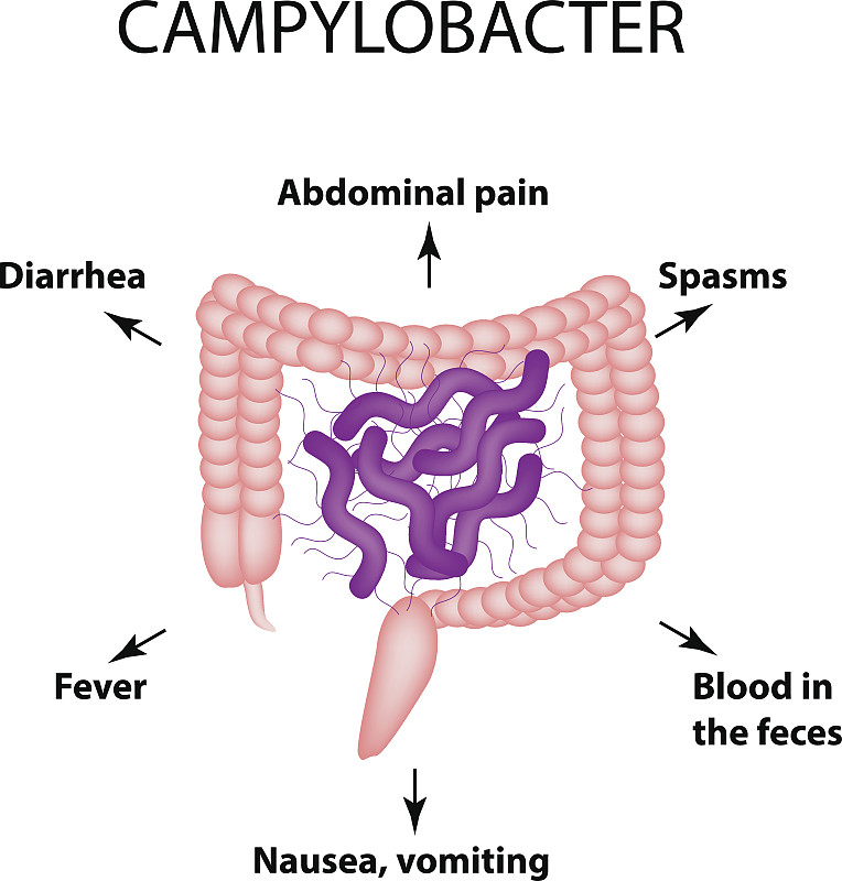 弯曲杆菌。致病的菌群。这种细菌会引起肠道疾病。感染的症状。信息图。矢量插图。