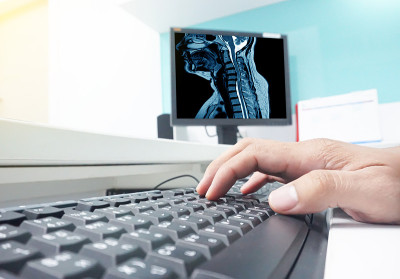 模糊特写手医生在键盘上取颈椎MRI。结果是病人。