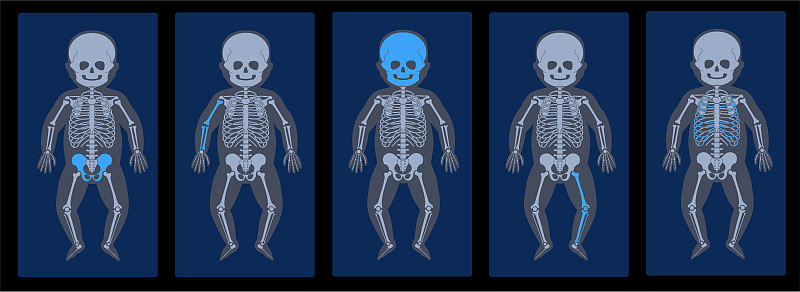 Skeleton x ray