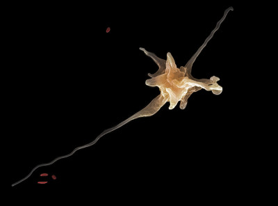 阿米巴(帕拉阿米巴perurans)， SEM