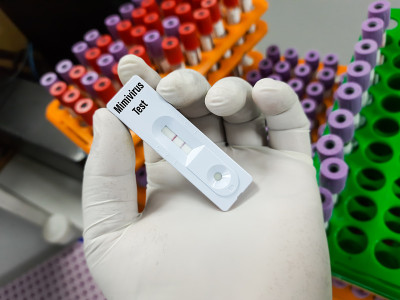 用于Mimivirus test, DNA virus, agent of human respir
