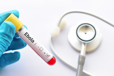 Ebolar测试