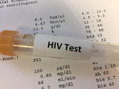 HIV实验室检测用试管
