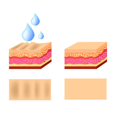 Vector illustration with cosmetic filler or Dermal