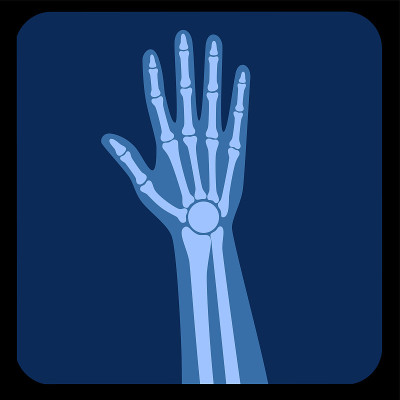 Pain4_Skeleton
