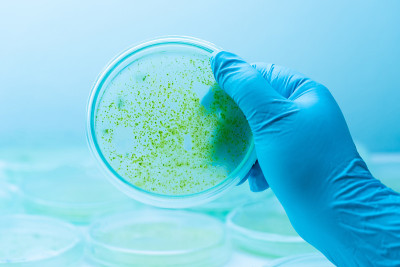 培养基板上蓝藻菌落，微生物学。