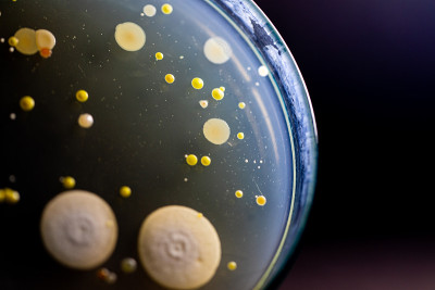 微生物实验室教育用土壤样品中细菌和霉菌在琼脂平板上生长的特点和不同形状菌落的背景。