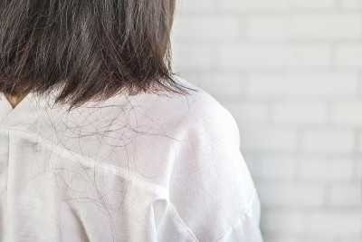 亚洲女性颈部和肩部有脱发问题