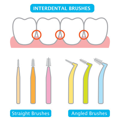 interdental brush and teeth illustration. dental a