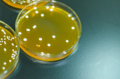 琼脂板上满是微生物和微生物