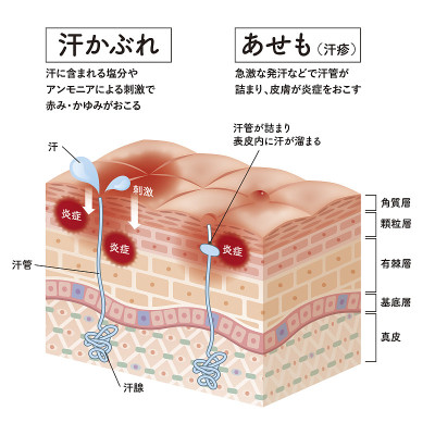 皮肤横截面31