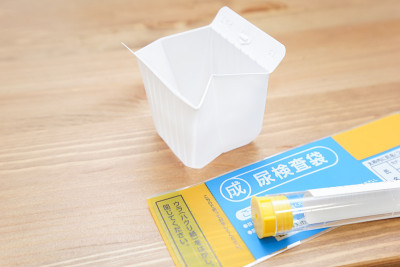 验尿