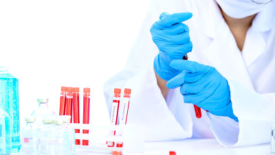 拥有冠状病毒疫苗和治疗方法的科学家。新型冠状病毒感染患者的治疗进展。防和阻止病毒爆发。