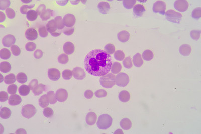 分段Netrophil