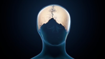 人类骨骼头骨顶骨解剖。3d插图