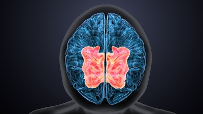 人脑交叉解剖学的三维渲染