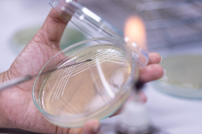教育用培养皿中酵母菌落特性研究。