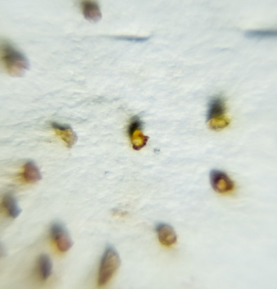 一张纸上有寄生虫。从皮肤上挤出的寄生虫。壁虱寄生虫。