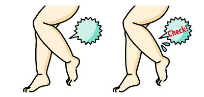 厚的女性legs-check