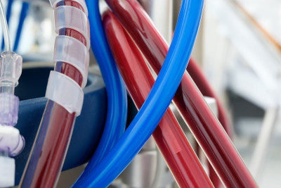 在重症监护室使用ecmo