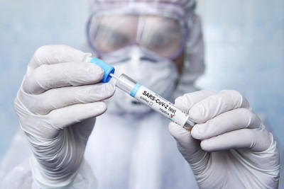 SARS-CoV-2(引起CONVID-19疾病的冠状病毒)检测阴性。粘膜涂片。痰液检查。穿着防护服