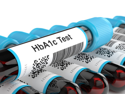 糖化血红蛋白(HbA1c)血管的3d渲染