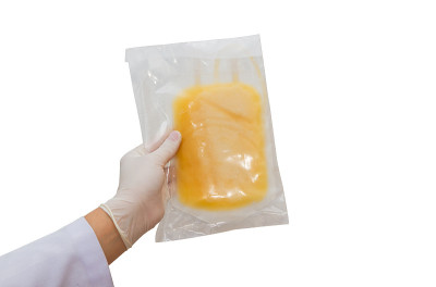 医生用手抓起血浆输血