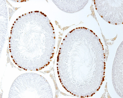 细精管。Spermatogonia
