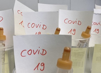 制备的新型冠状病毒SARS-CoV-2 COVID-19实验室检测