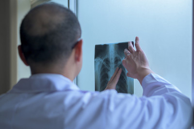 医生分析x光片，向病人展示保健理念