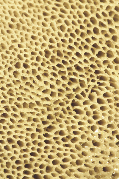 骨