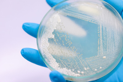 培养皿酵母菌，实验室微生物学教育。