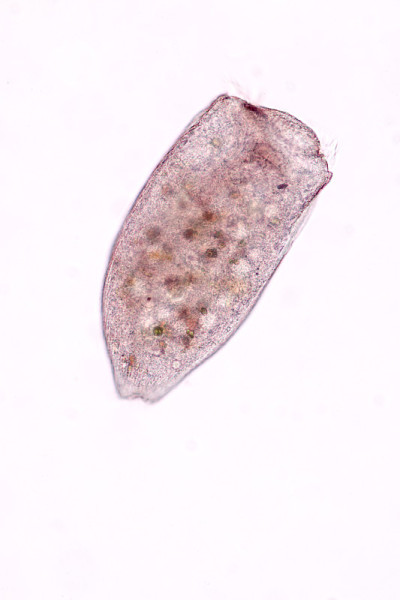Stentor，有时被称为喇叭微生物，是一种滤食性异养纤毛虫属，是显微镜下废水中异养生物的代表。