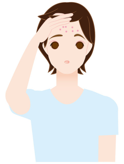 痤疮,额头,男性