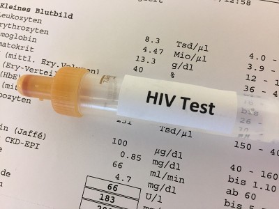 HIV实验室检测用试管