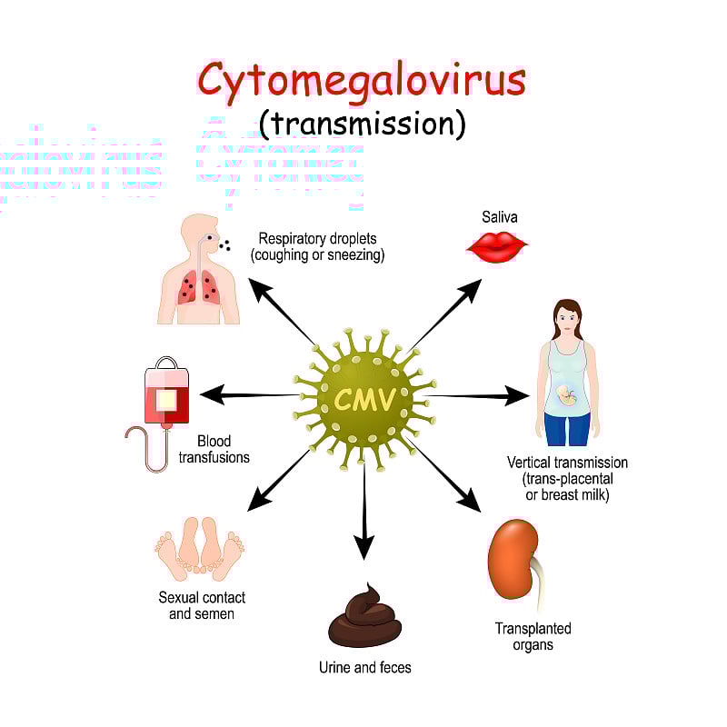 Cytomegalovirus infects humans